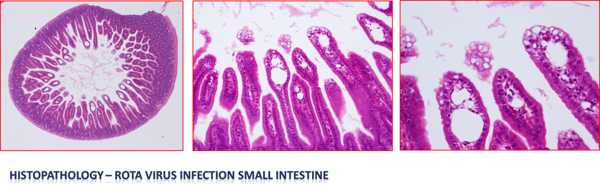 Rota Virus Infection histopathology images