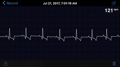 ECG screen