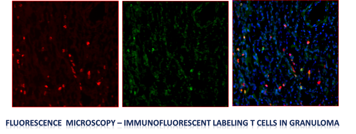 fluorescence microscopy